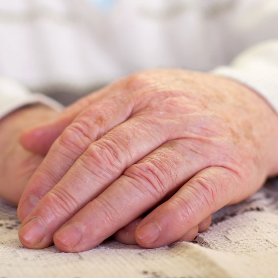 Tratamiento de la mano degenerativa en la Unidad de Traumatología y Cirugía de mano y muñeca