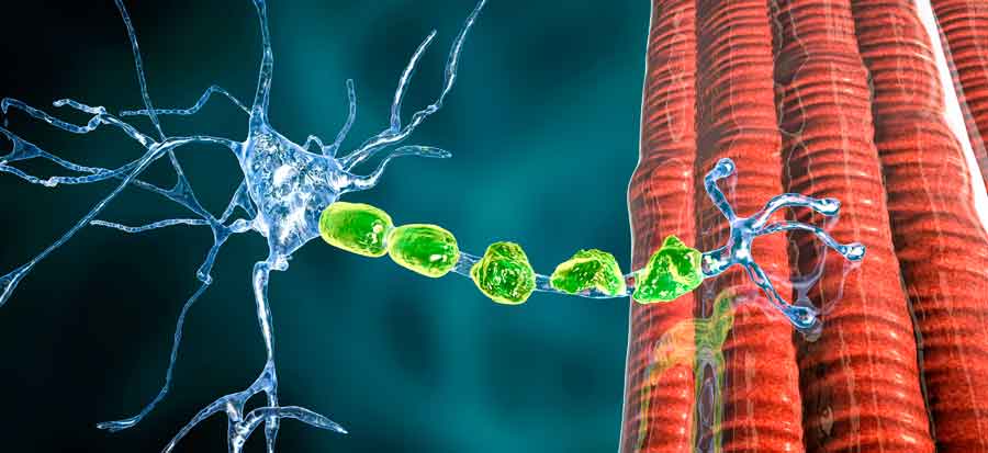 Causas de las neuropatías perifércias del miembro superior mano y muñeca